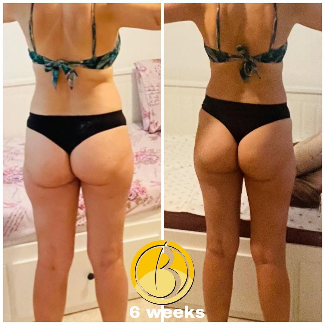 Transformare Before After